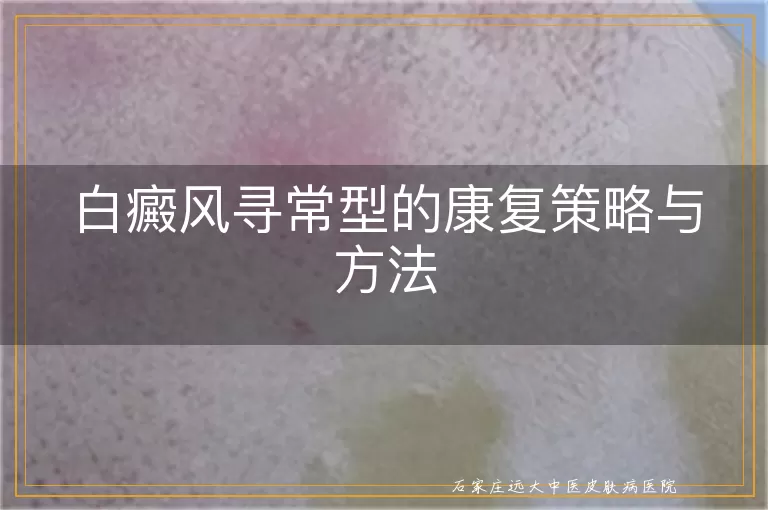 白癜风寻常型的康复策略与方法