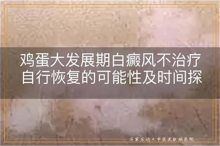 鸡蛋大发展期白癜风不治疗自行恢复的可能性及时间探讨