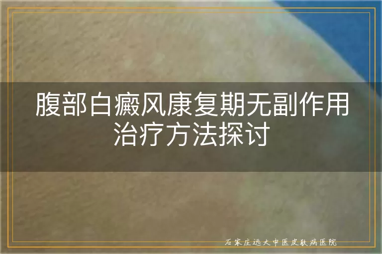 腹部白癜风康复期无副作用治疗方法探讨