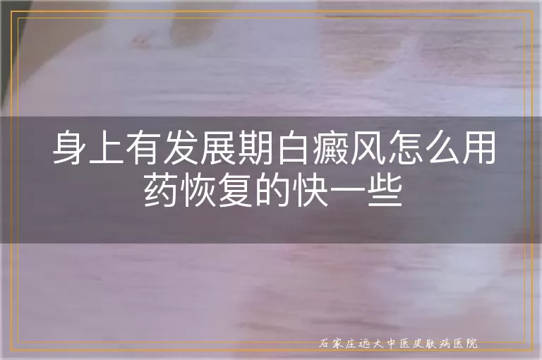 身上有发展期白癜风怎么用药恢复的快一些