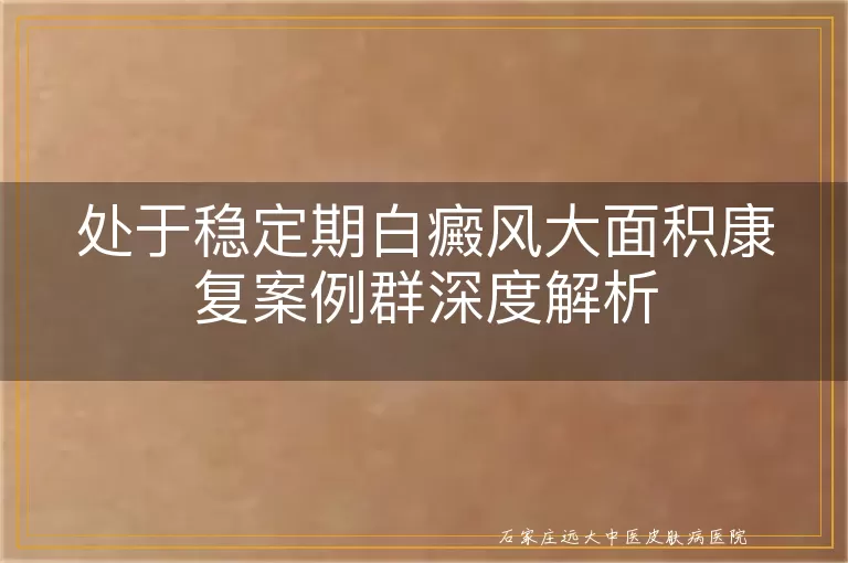 处于稳定期白癜风大面积康复案例群深度解析