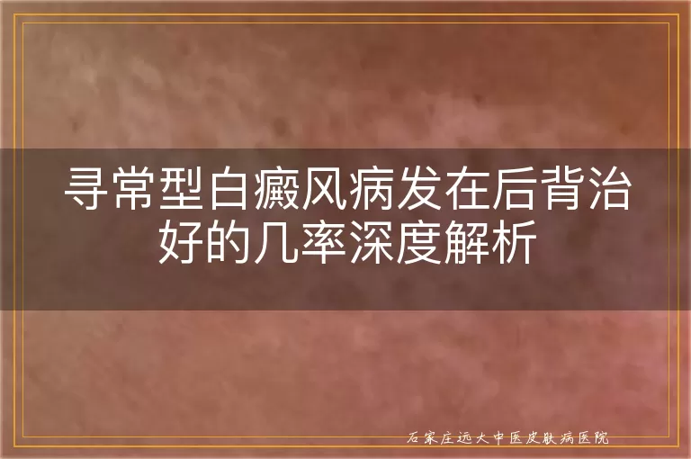 寻常型白癜风病发在后背治好的几率深度解析