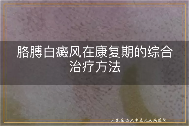 胳膊白癜风在康复期的综合治疗方法