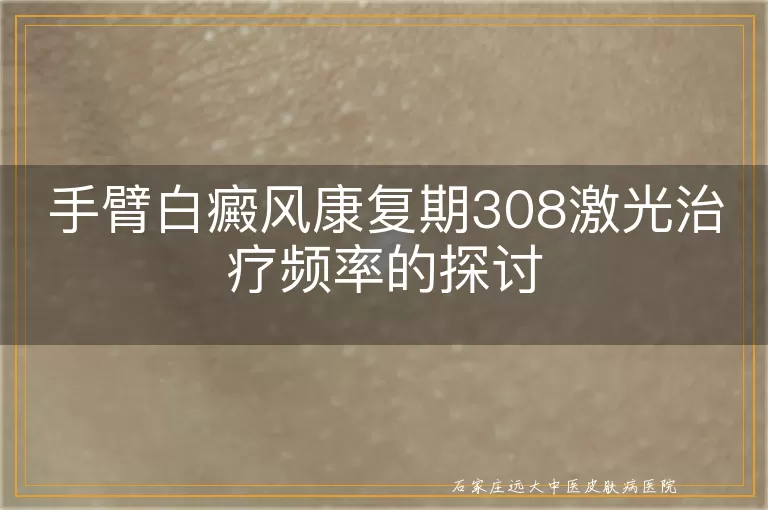 手臂白癜风康复期308激光治疗频率的探讨
