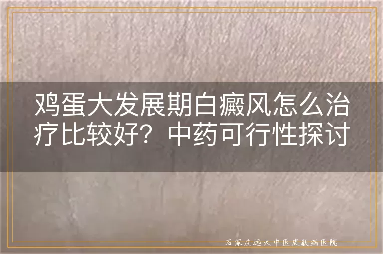 鸡蛋大发展期白癜风怎么治疗比较好？中药可行性探讨