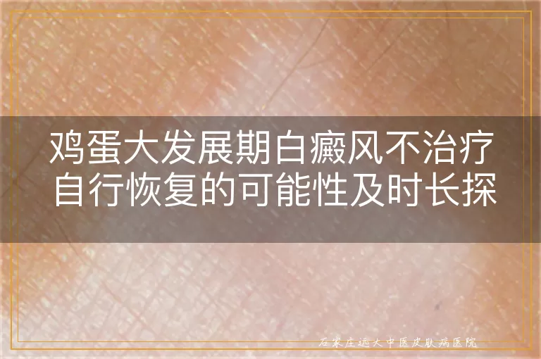 鸡蛋大发展期白癜风不治疗自行恢复的可能性及时长探讨