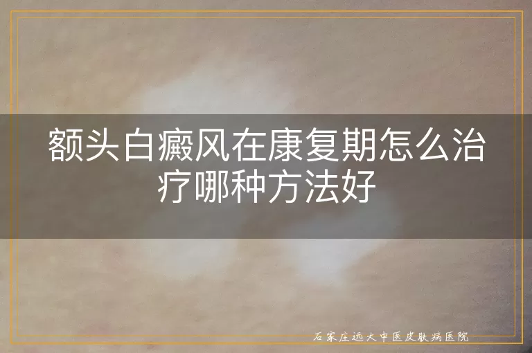 额头白癜风在康复期怎么治疗哪种方法好