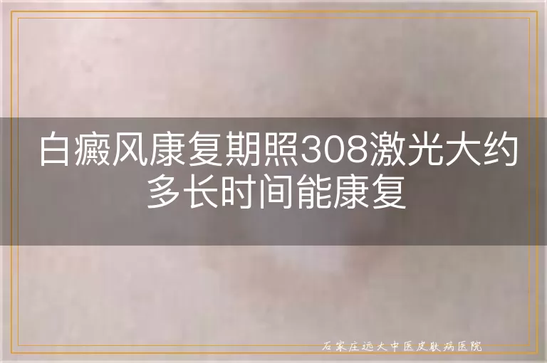 白癜风康复期照308激光大约多长时间能康复