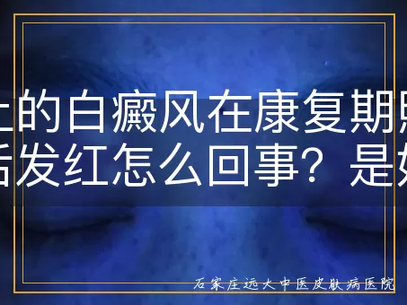 身上的白癜风在康复期照激光后发红怎么回事？是好转的迹象吗？