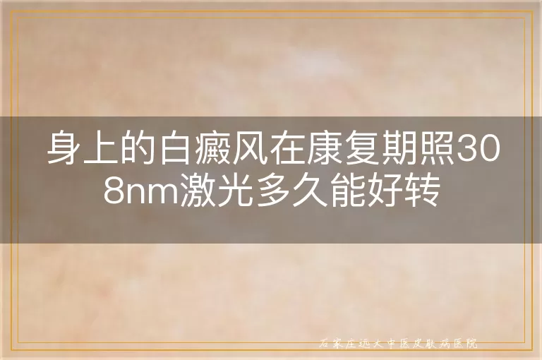 身上的白癜风在康复期照308nm激光多久能好转