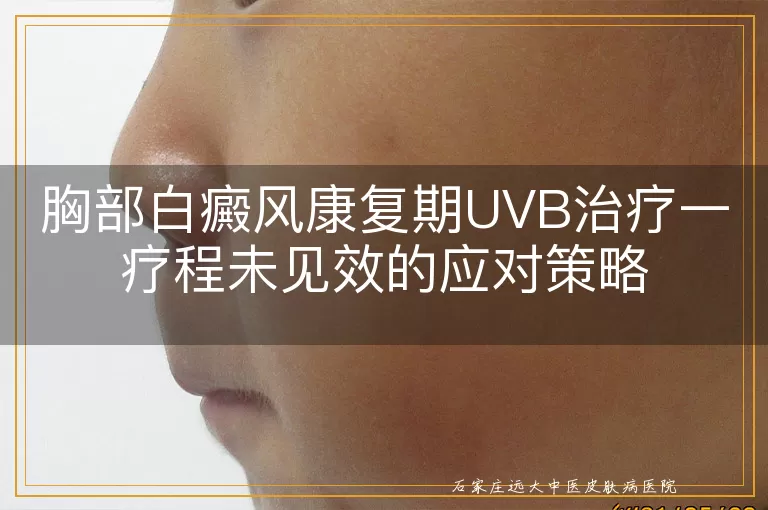 胸部白癜风康复期UVB治疗一疗程未见效的应对策略