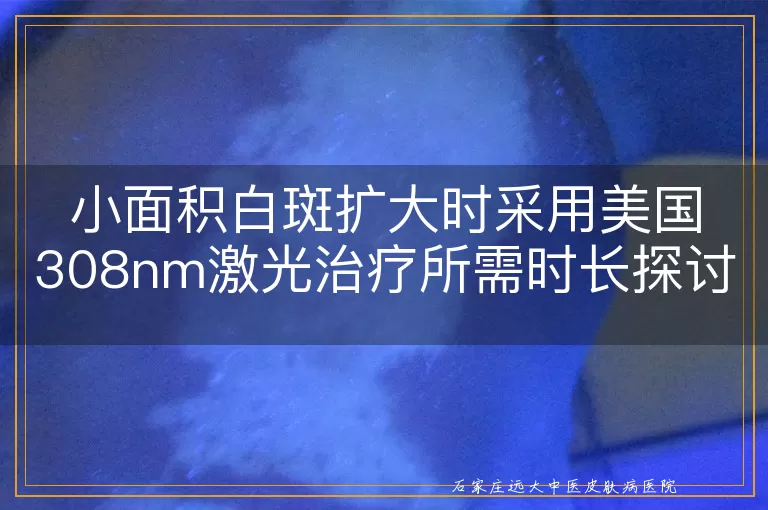小面积白斑扩大时采用美国308nm激光治疗所需时长探讨