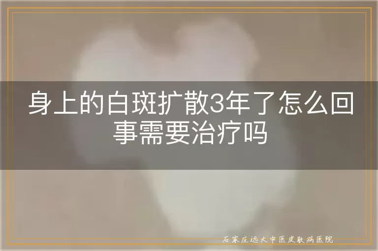 身上的白斑扩散3年了怎么回事需要治疗吗