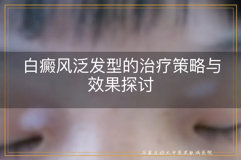 白癜风泛发型的治疗策略与效果探讨