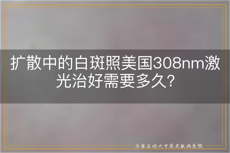 扩散中的白斑照美国308nm激光治好需要多久？