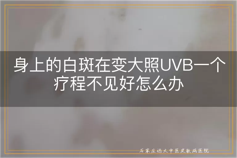 身上的白斑在变大照UVB一个疗程不见好怎么办