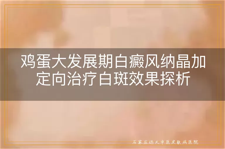 鸡蛋大发展期白癜风纳晶加定向治疗白斑效果探析