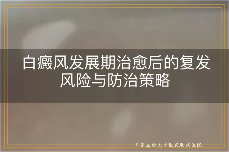 白癜风发展期治愈后的复发风险与防治策略