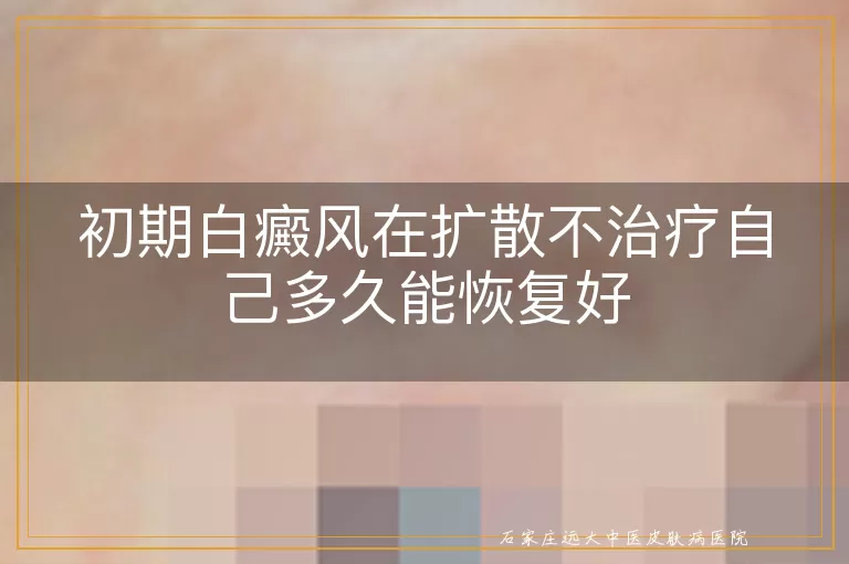 初期白癜风在扩散不治疗自己多久能恢复好