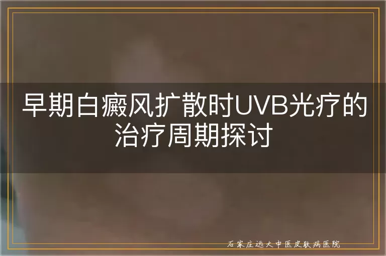 早期白癜风扩散时UVB光疗的治疗周期探讨