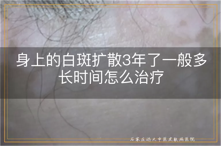 身上的白斑扩散3年了一般多长时间怎么治疗