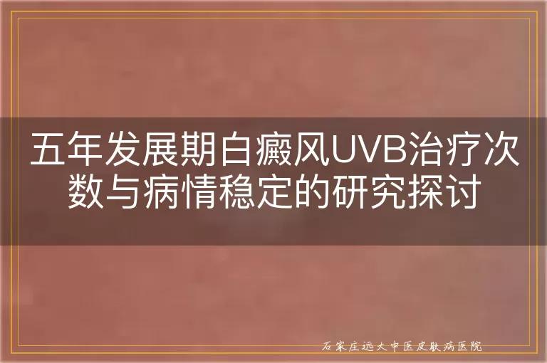 五年发展期白癜风UVB治疗次数与病情稳定的研究探讨