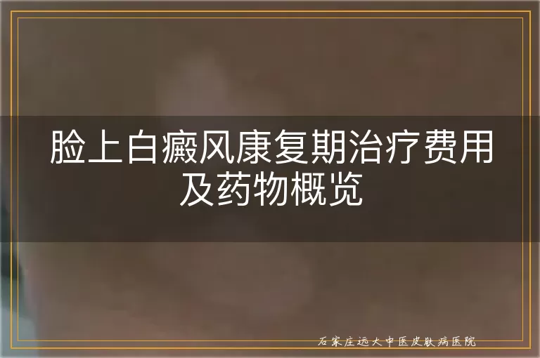 脸上白癜风康复期治疗费用及药物概览