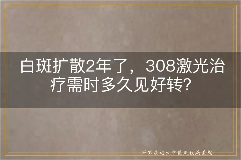 白斑扩散2年了，308激光治疗需时多久见好转？