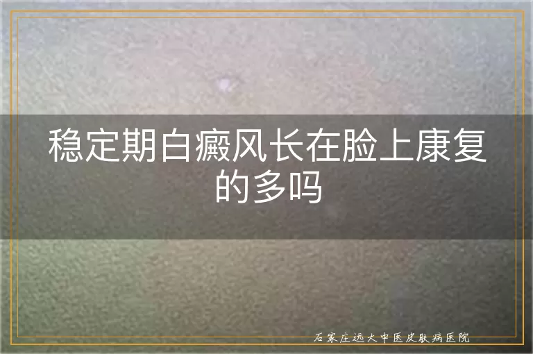 稳定期白癜风长在脸上康复的多吗