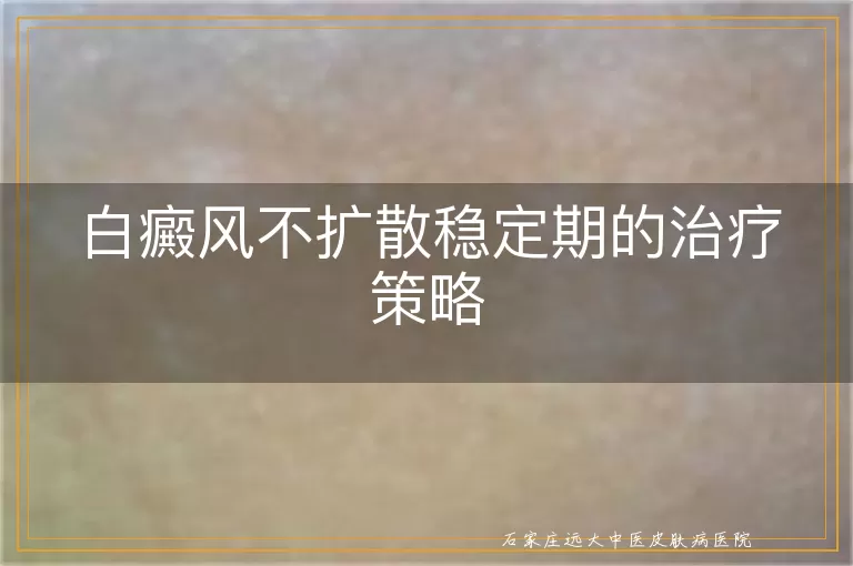 白癜风不扩散稳定期的治疗策略