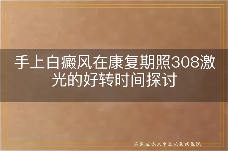 手上白癜风在康复期照308激光的好转时间探讨