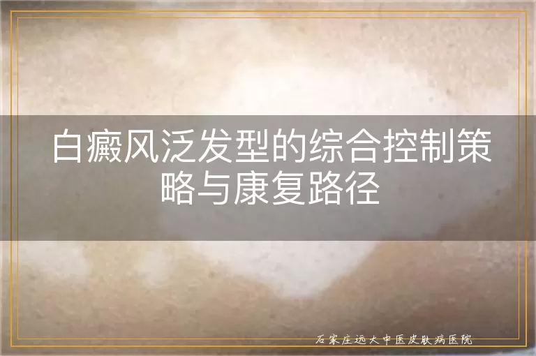 白癜风泛发型的综合控制策略与康复路径