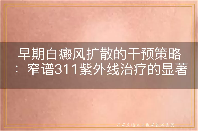 早期白癜风扩散的干预策略：窄谱311紫外线治疗的显著效果