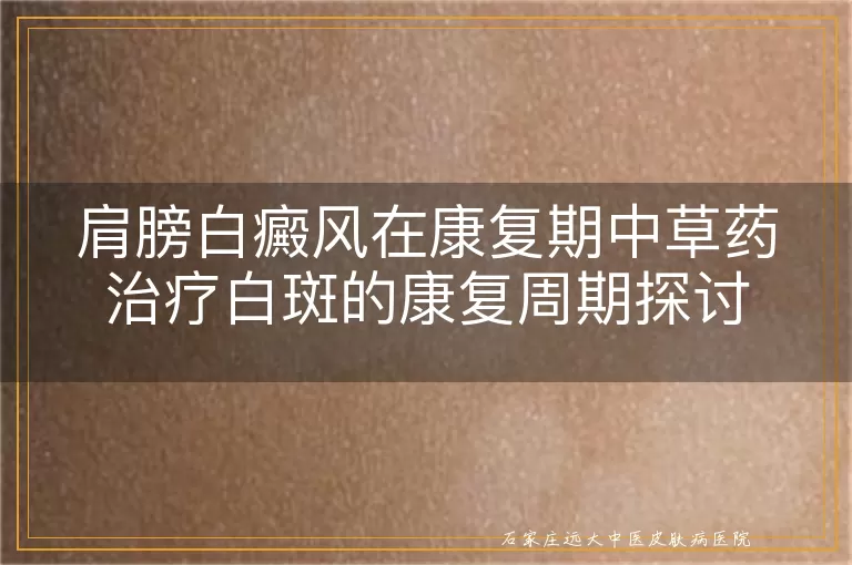 肩膀白癜风在康复期中草药治疗白斑的康复周期探讨
