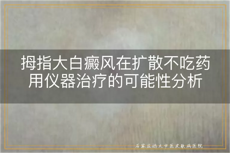 拇指大白癜风在扩散不吃药用仪器治疗的可能性分析