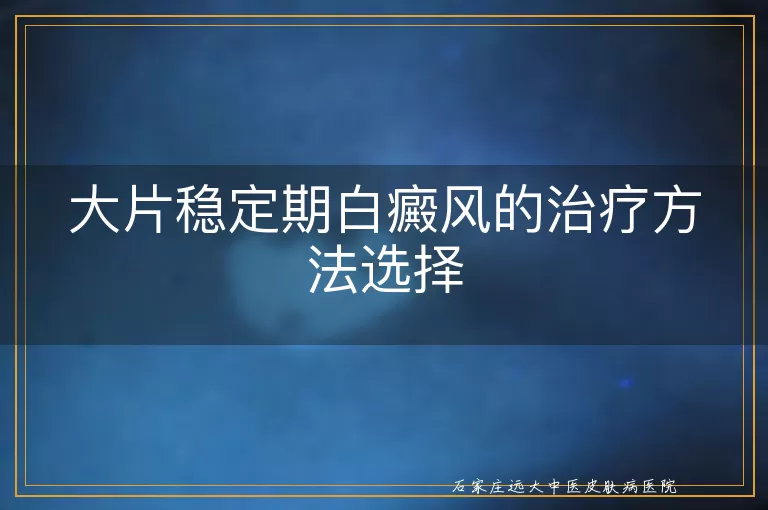 大片稳定期白癜风的治疗方法选择