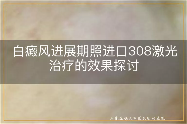 白癜风进展期照进口308激光治疗的效果探讨