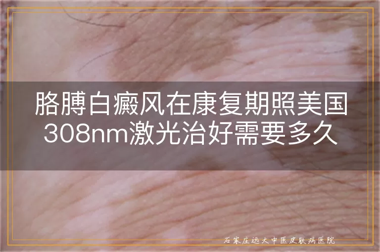 胳膊白癜风在康复期照美国308nm激光治好需要多久