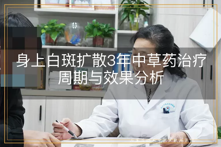 身上白斑扩散3年中草药治疗周期与效果分析