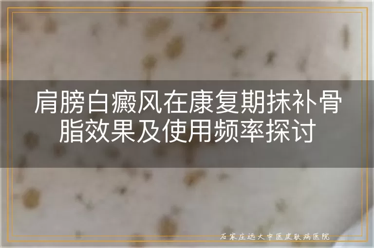 肩膀白癜风在康复期抹补骨脂效果及使用频率探讨