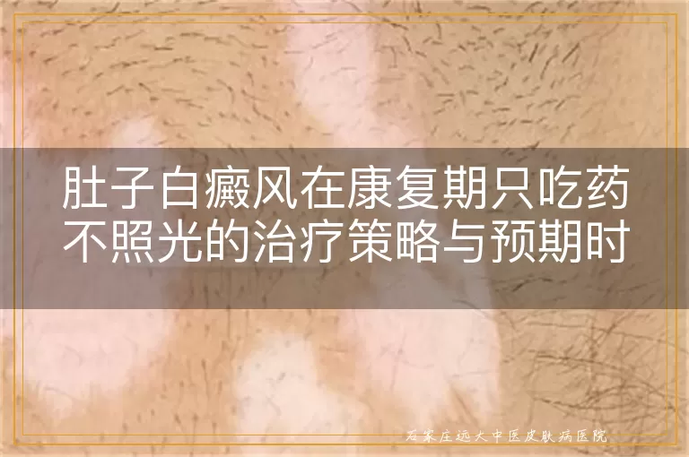 肚子白癜风在康复期只吃药不照光的治疗策略与预期时长