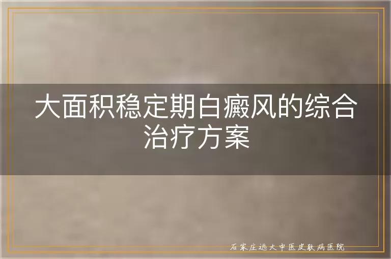 大面积稳定期白癜风的综合治疗方案