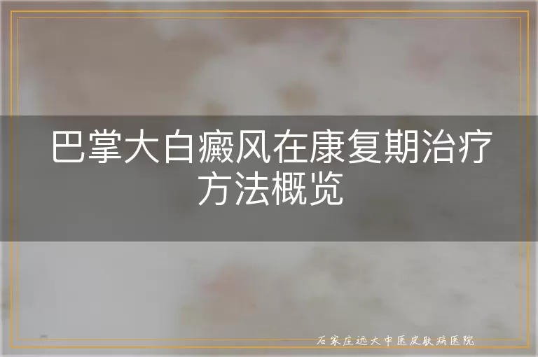巴掌大白癜风在康复期治疗方法概览