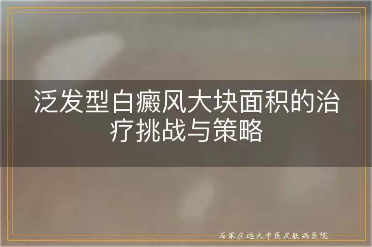 泛发型白癜风大块面积的治疗挑战与策略