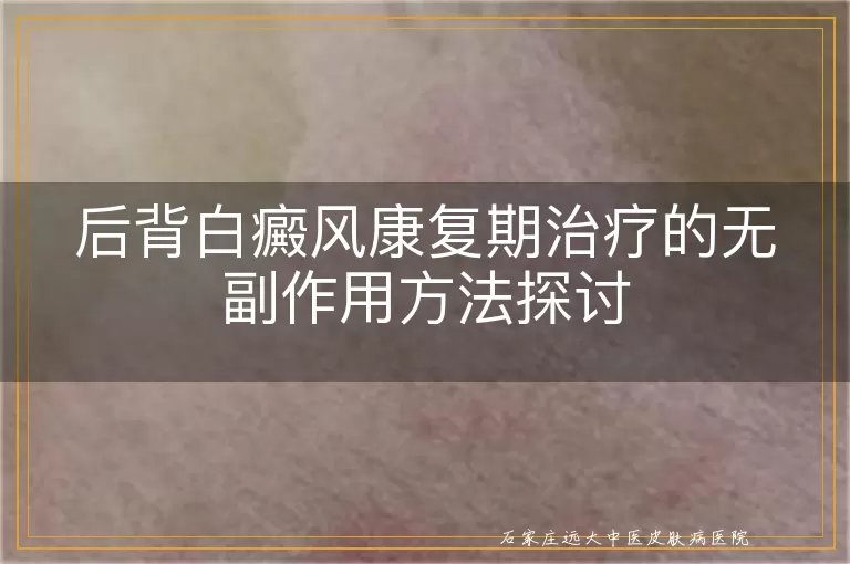 后背白癜风康复期治疗的无副作用方法探讨