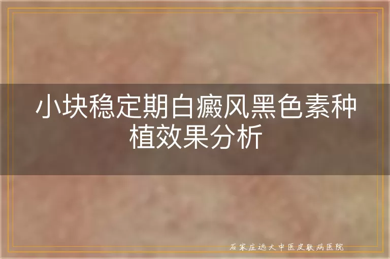 小块稳定期白癜风黑色素种植效果分析