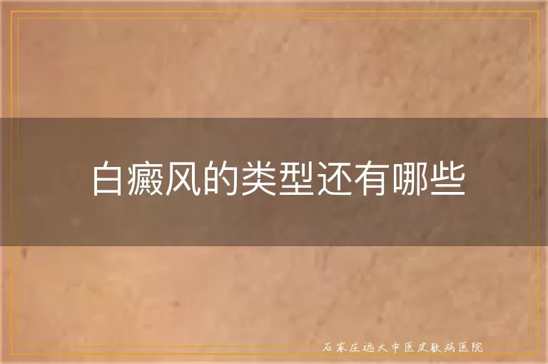白癜风的类型还有哪些