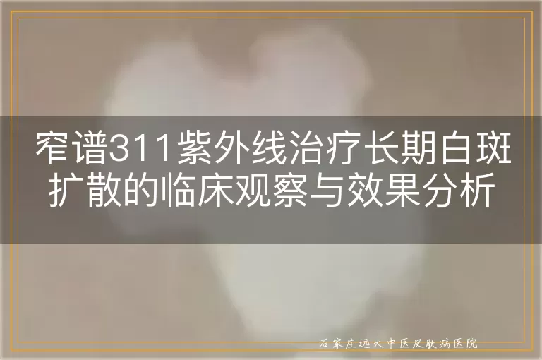 窄谱311紫外线治疗长期白斑扩散的临床观察与效果分析