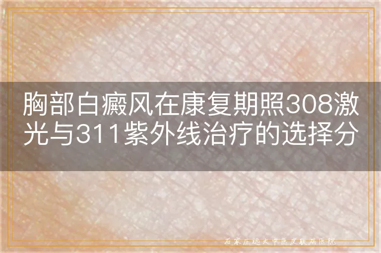 胸部白癜风在康复期照308激光与311紫外线治疗的选择分析