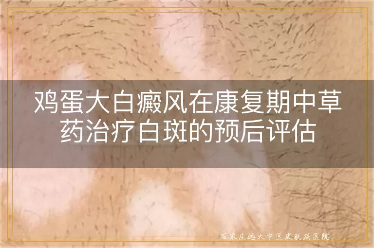 鸡蛋大白癜风在康复期中草药治疗白斑的预后评估